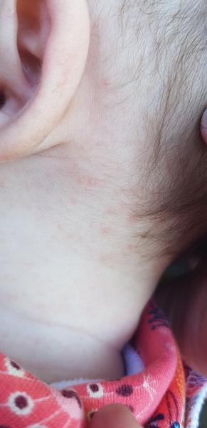 Potničky nebo spalničky? 😧😯