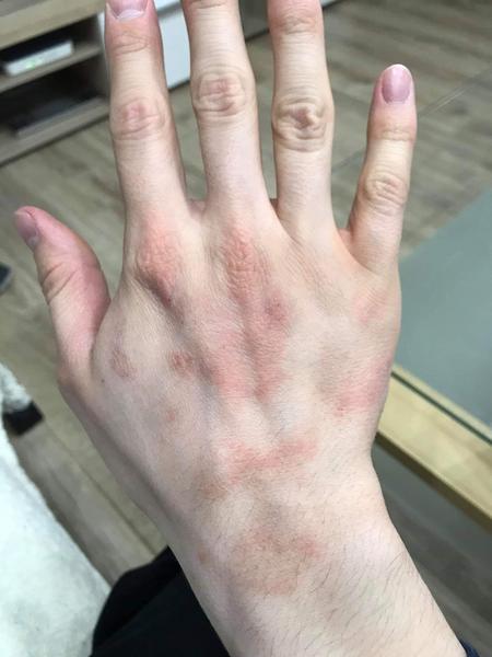 Kožní problém. Nemáte podobnou zkušenost?