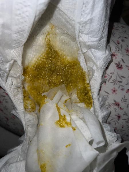 Častá stolice u kojence na Aptamil Pre. Je to normální?