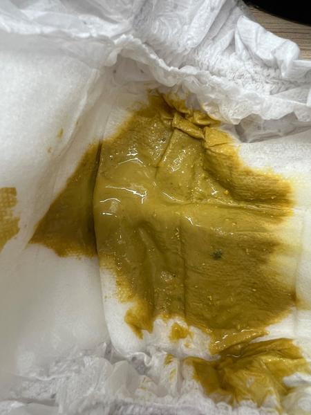 Řídká stolice u miminka na umělé výživě. Je to normální?