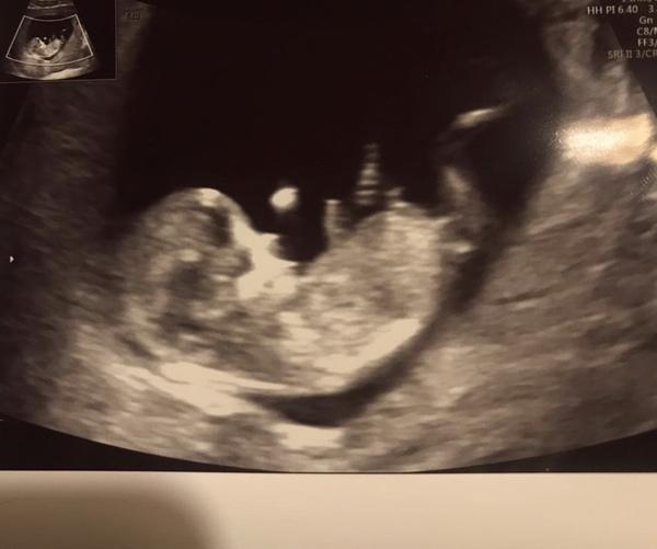 Holčička nebo kluk. Poznáte?