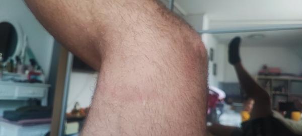 Červené ohraničení na noze. Co by to mohlo být?