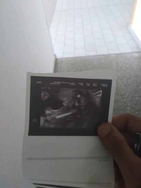 Co vidíte na obrázku z 32.tt?