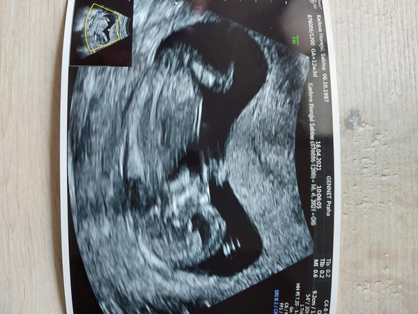 Pohlaví dle utz 14.tt. Nenapoví někdo?