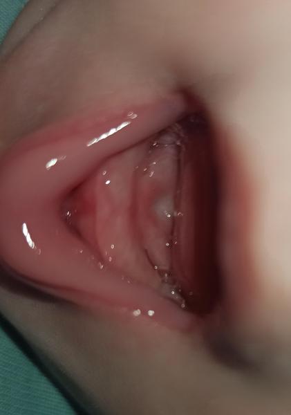 Může miminku v 4,5 měsících růst první zoubek?