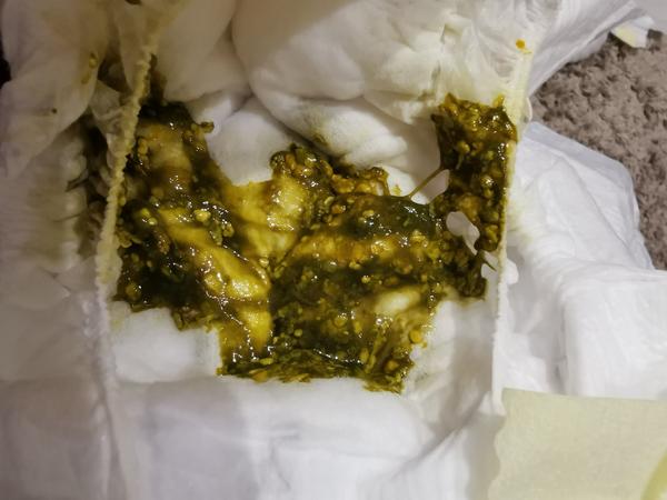 Hlen ve stolici + teplota 37,3 °C. Poradíte, prosím?