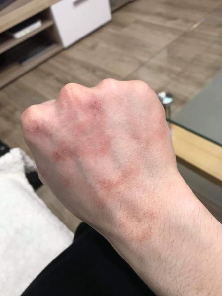 Kožní problém. Nemáte podobnou zkušenost?