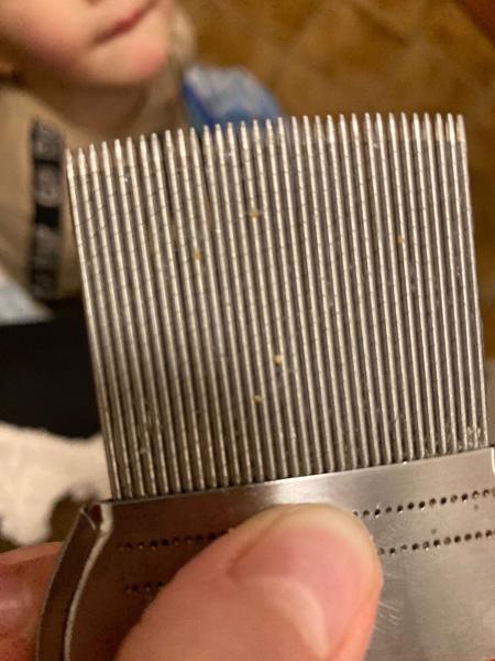 Jak rozlišit vši od lupů u dětí?