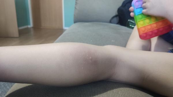 Nevíte, co je to za fleky na kůži?