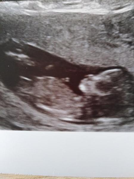 Pohlaví. Tipnete si? 🙂