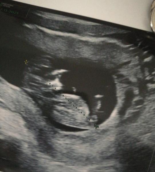 Pohlaví miminka. Poznáte někdo?