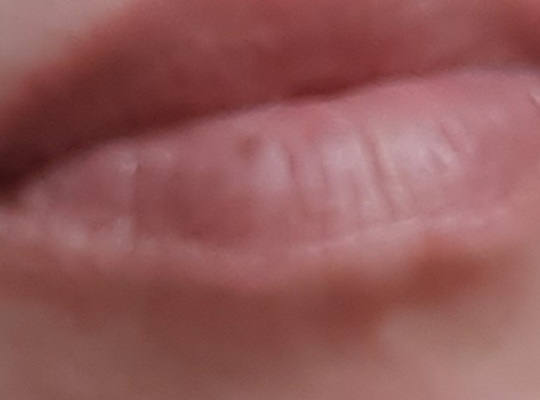 Máte zkušenost s hnědým pigmentem na rtech?