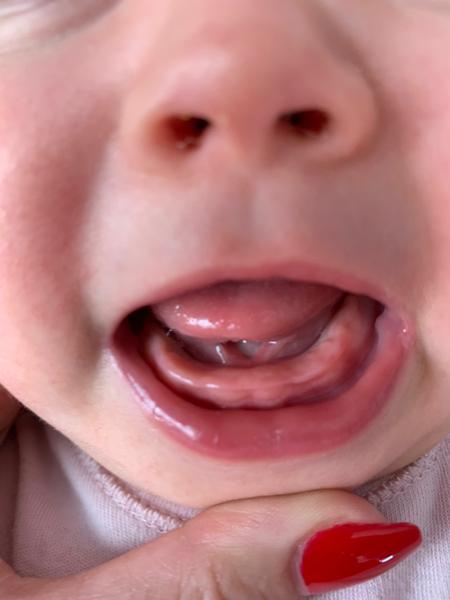 Zuby. Mohlo by to být tím?