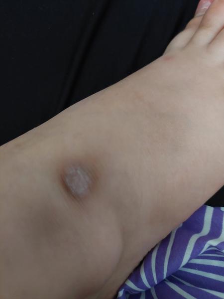 Zkušenosti s výskytem suchých fleků na tváři?