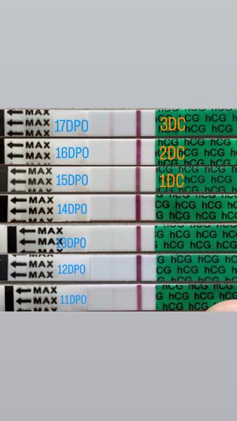 Zánět močových cest v těhotenství. Jaké máte zkušenosti?