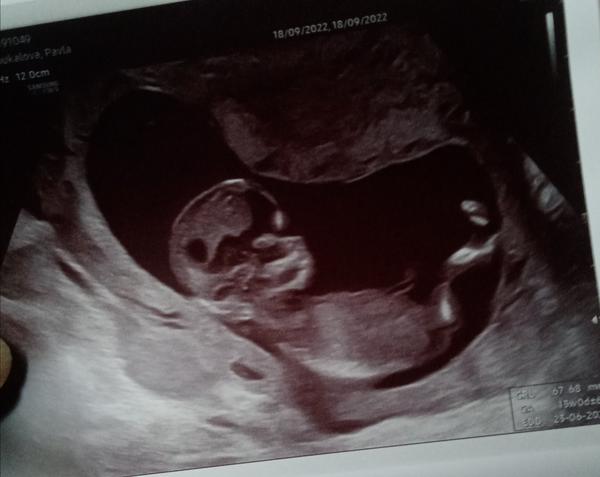 Pohlaví. Poznáte z fotky?