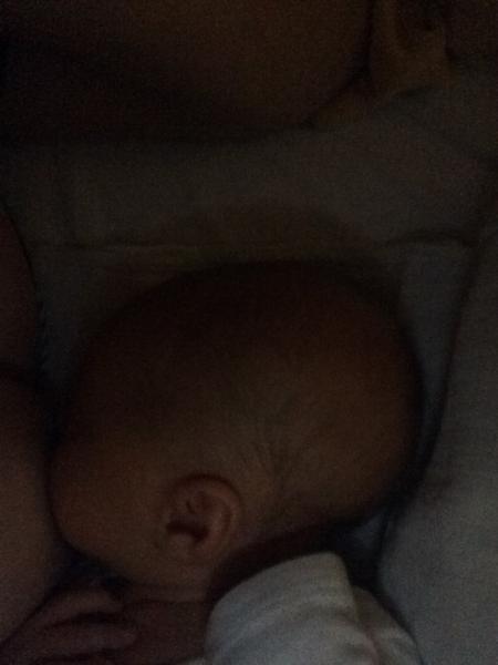 Divný tvar hlavičky. Mám to nějak řešit?