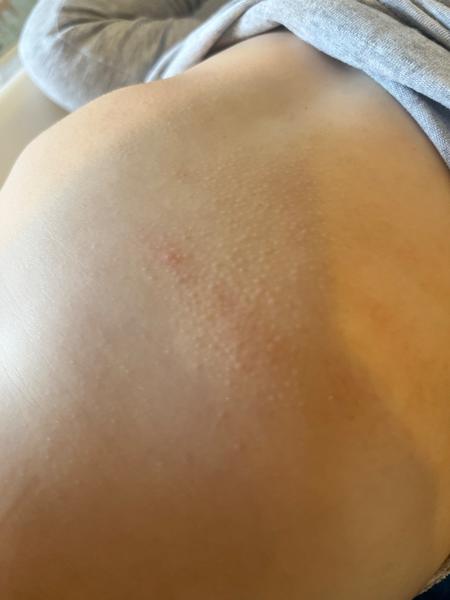 Zkušenosti s ekzémem u dětí a doporučené přípravky