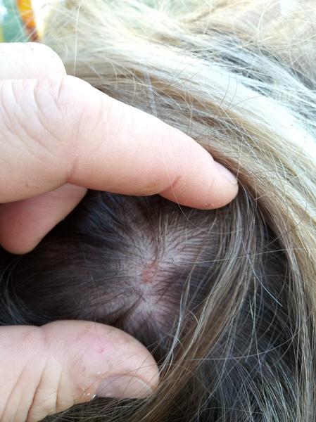 Je toto ve vlasech nebezpečné? Zjistěte více!