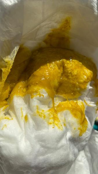 Může změna stolice a neklid u kojence znamenat reflux?