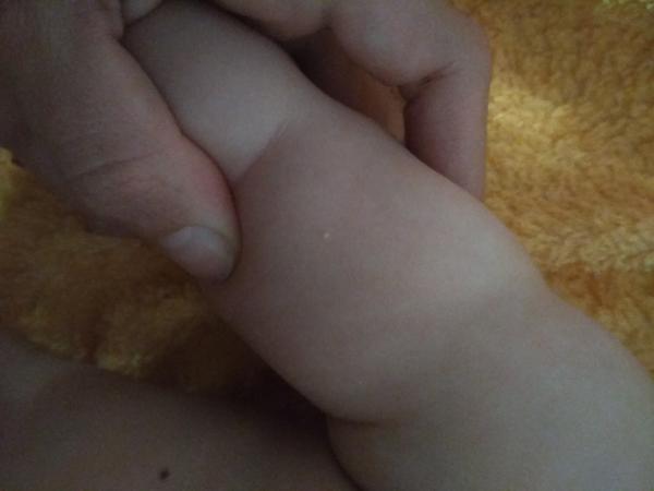 Co to může být za pupínky?