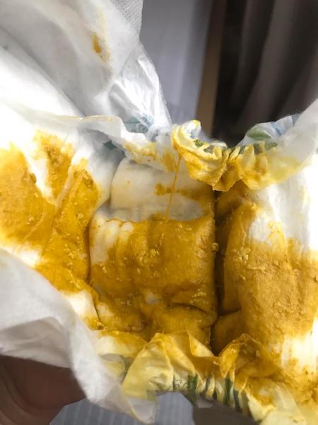 Stolice kojence. Je konzistence v normě?