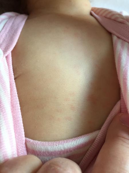 Prosím, co to může být?