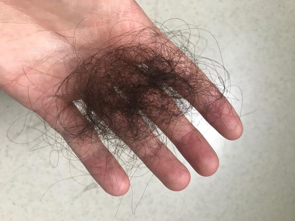 Dr. nechce vzít krev na rozbor. Jak řešit?