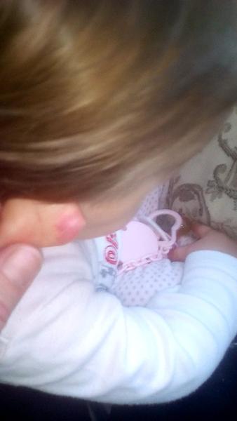 Podlitina na oušku, máte zkušenost?