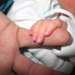 „Hlavně, že je dítě zdravé.“ Věta, která umlčela už mnoho maminek.