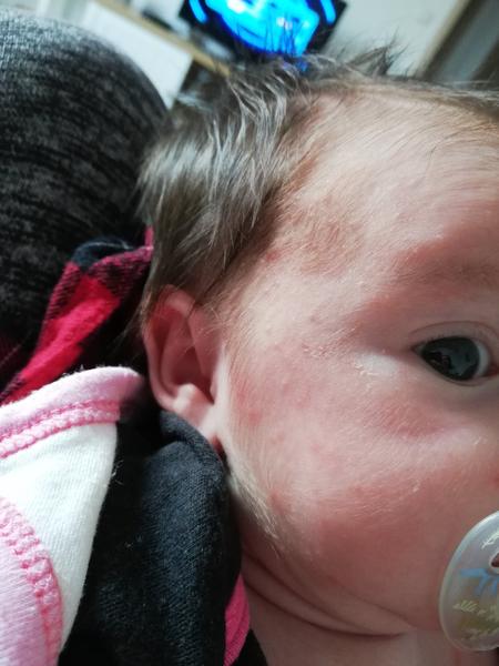 Pupínky, potničky. Poradíte, prosím?