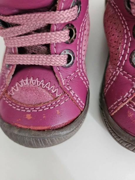 Kožené boty protetika, vel. 19, stélka 12 cm, protetika,19