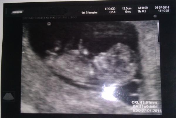 Holka nebo kluk? Prosím o názory