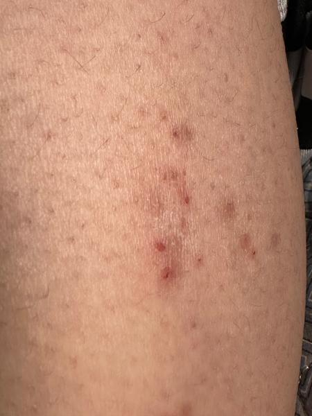 Jak rozpoznat svědivé skvrny na těle?