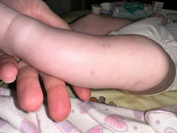 Co znamenají tečky na noze miminka?