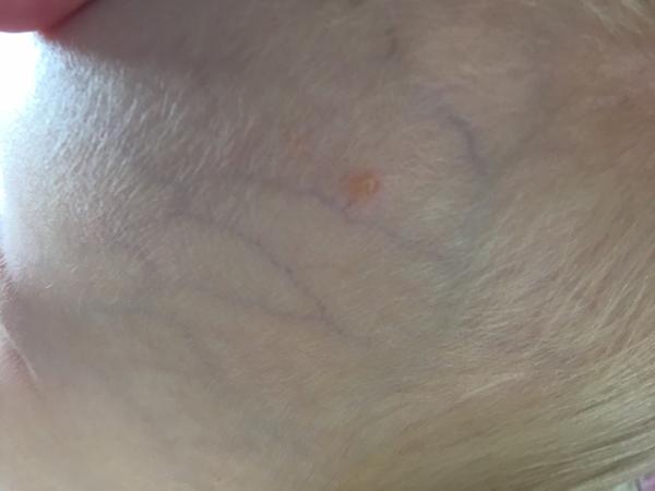 Co by mohly být tyto pupínky?