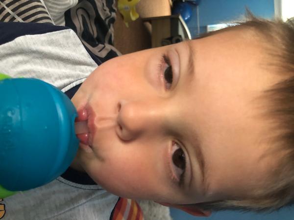 Nateklé oko. Co by to mohlo být? Zajít raději k lékaři?