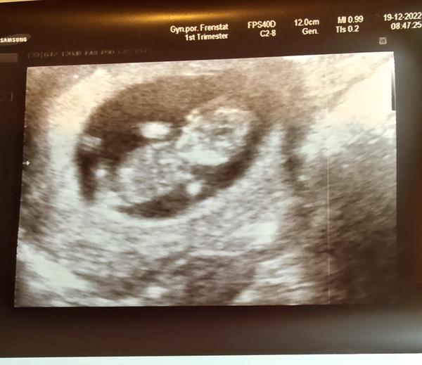 Tipněte si: Kluk nebo holka?