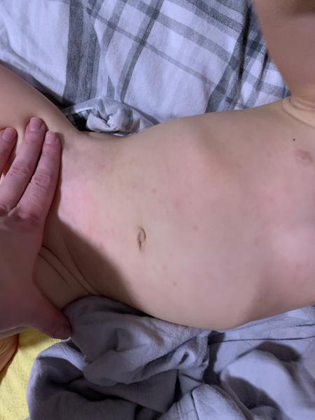 Šestá nemoc. Můžou to být příznaky? Mám se obávat?