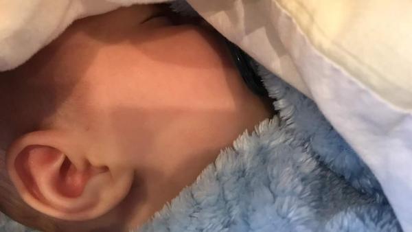 Ekzém či kvasinka?