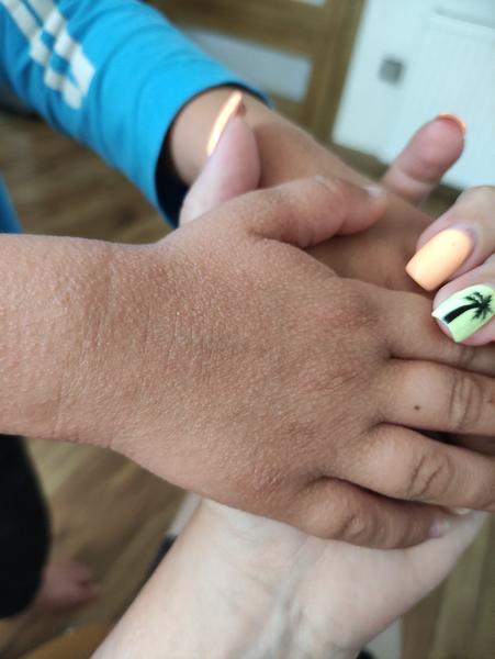 Mohou to být potničky?