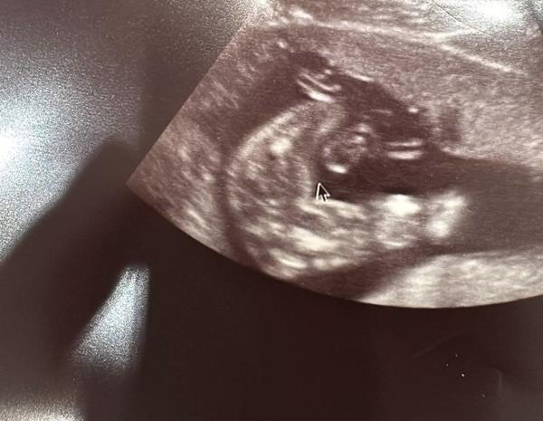 Je možné, že se holčička může změnit na kluka?