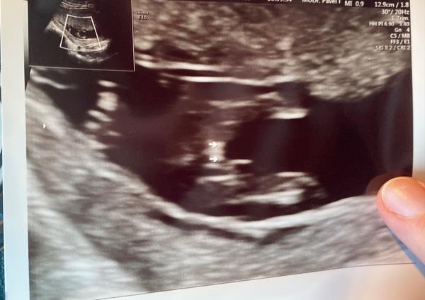 Pohlaví. Je to holka?