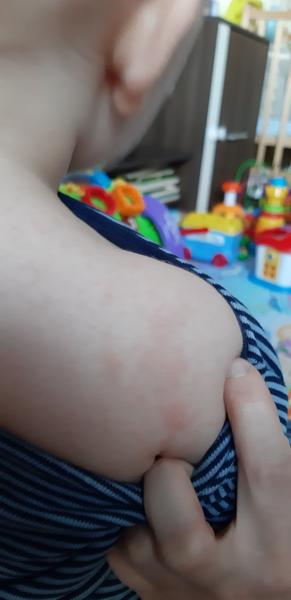 Ložiska s pupínkama. Nevíte, co by to mohlo být?