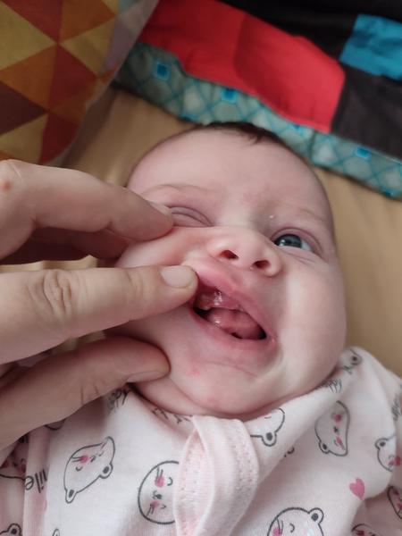 Může mít pětitýdenní dítě zoubky?