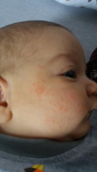 Nevíte, co je to za pupínky?