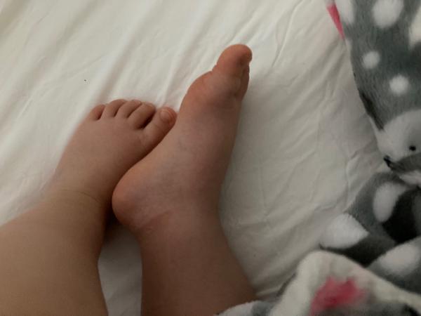 Výbava na léto. Jaké botičky pořídit?