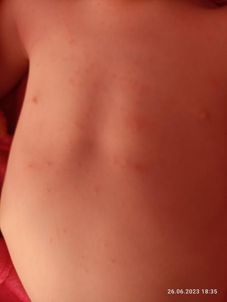 Jak poznat potničky u dětí?