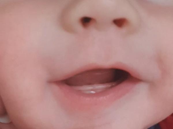 Můžou to být zuby?