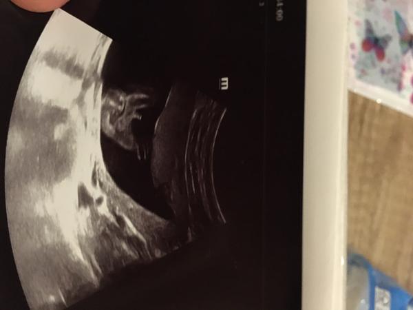 Je to tutový chlapeček?